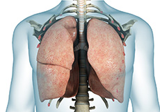 Chronic Respiratory Failure